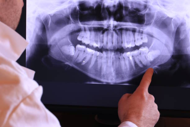 Dentist for Dental Trauma in SC